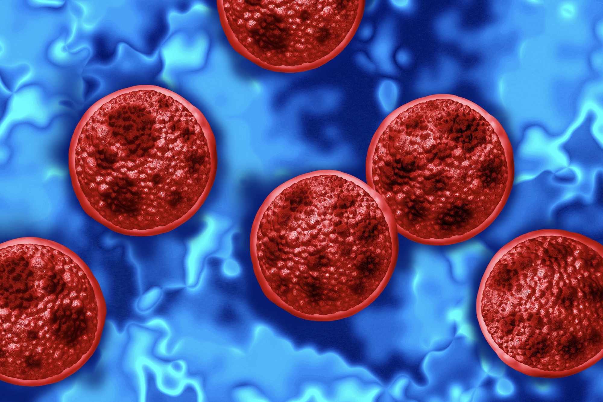 DSU food safety experts explain what consumers should know about cyclosporiasis